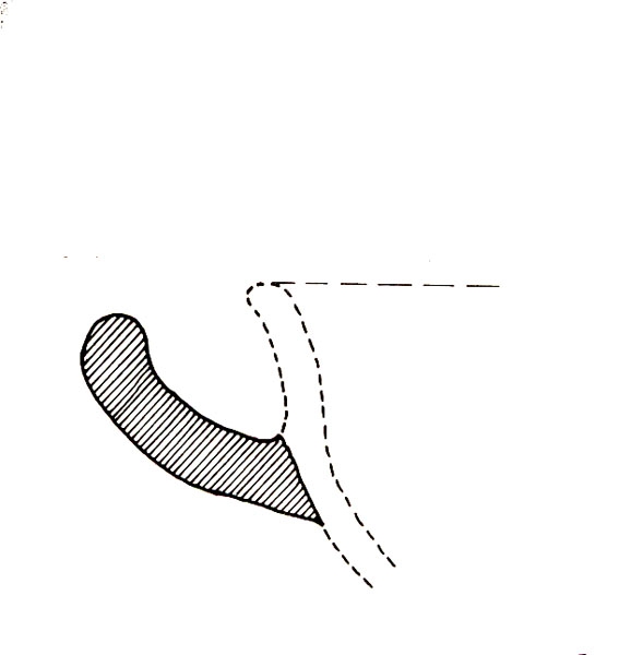 PELLICER ET ALII. 1983, fig. 47, 456