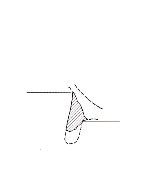 DOCTER 2000, fig. 11, e