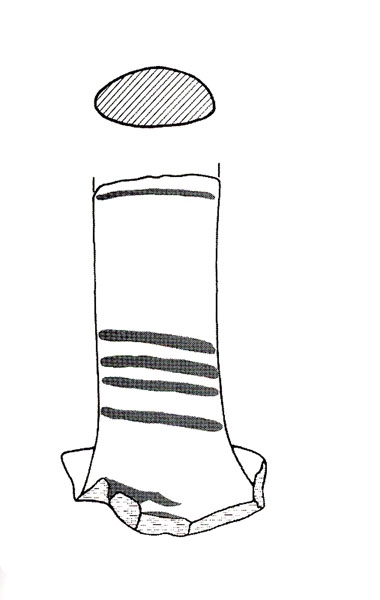 DOCTER 2000, fig. 11, a